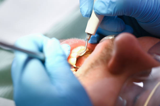 Best Emergency Root Canal Treatment in Wonder Lake, IL