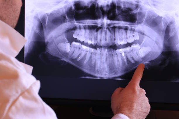 Best Emergency TMJ Treatment in Wonder Lake, IL