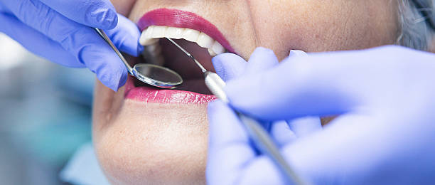 Best Emergency Treatment for Dental Infections or Abscesses in Wonder Lake, IL
